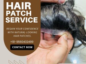 Hair Patch in Delhi – Natural Look Guaranteed