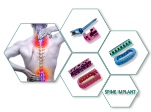 Spine Implants Manufacturers in india