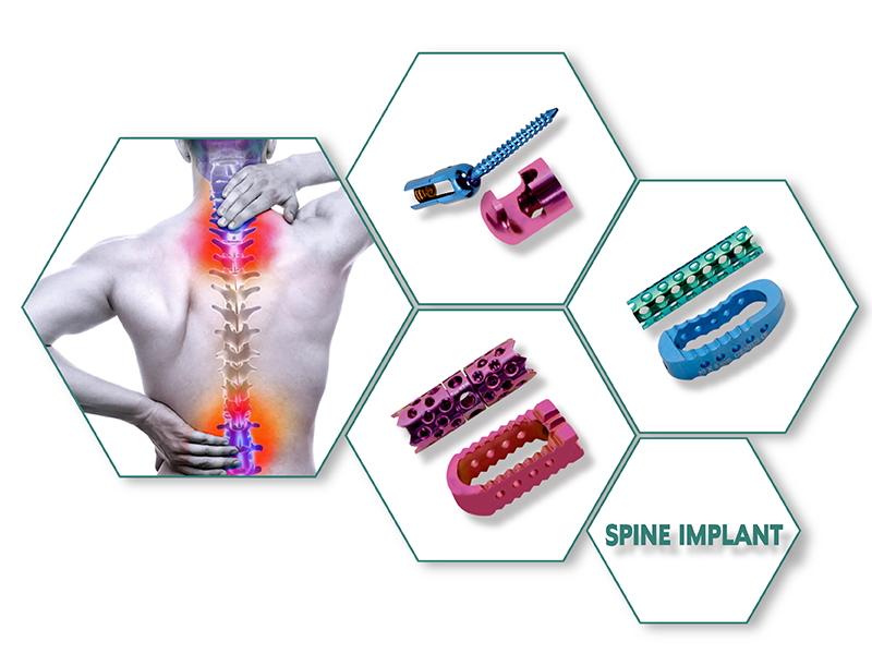 Spine Implants Manufacturers in india
